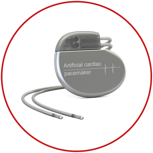 pacemaker-implant-in-delhi